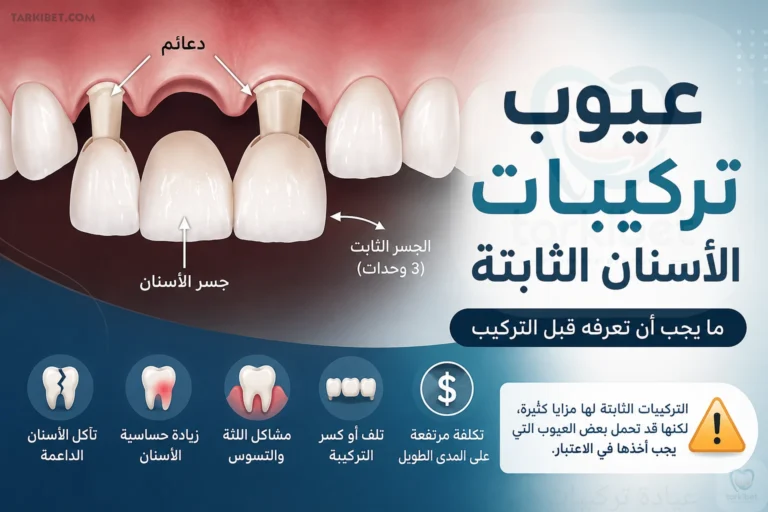 عيوب تركيبات الأسنان الثابتة